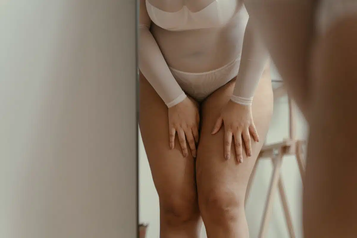 cellulite  fitness